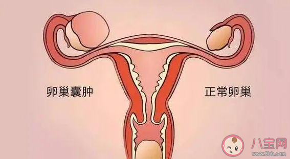 为什么卵巢对女人如此重要 卵巢早衰有哪些症状