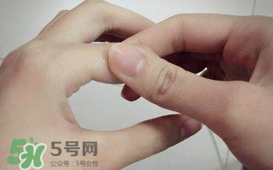 痛风有什么症状?女性痛风的初期症状 痛风有什么症状?女性痛风的初期症状