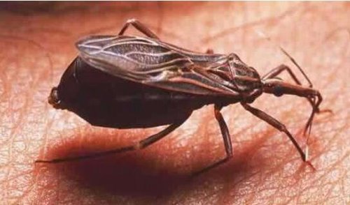 世界上最吓人的虫子盘点 非洲麦地那龙线虫最吓人(图片)