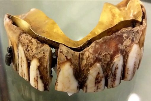 200年前黄金假牙是怎么回事?现在价值多少估价多少钱?
